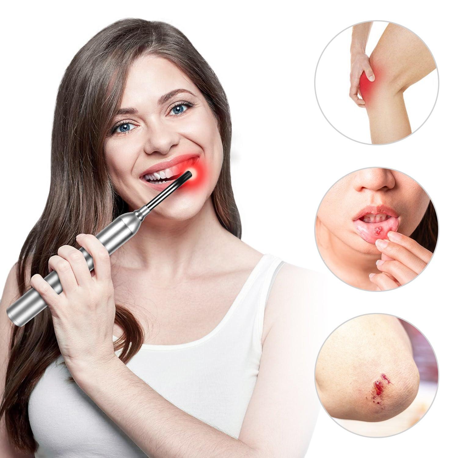 Youlumi Red Light Cold Sore Treatment Device - youlumistore