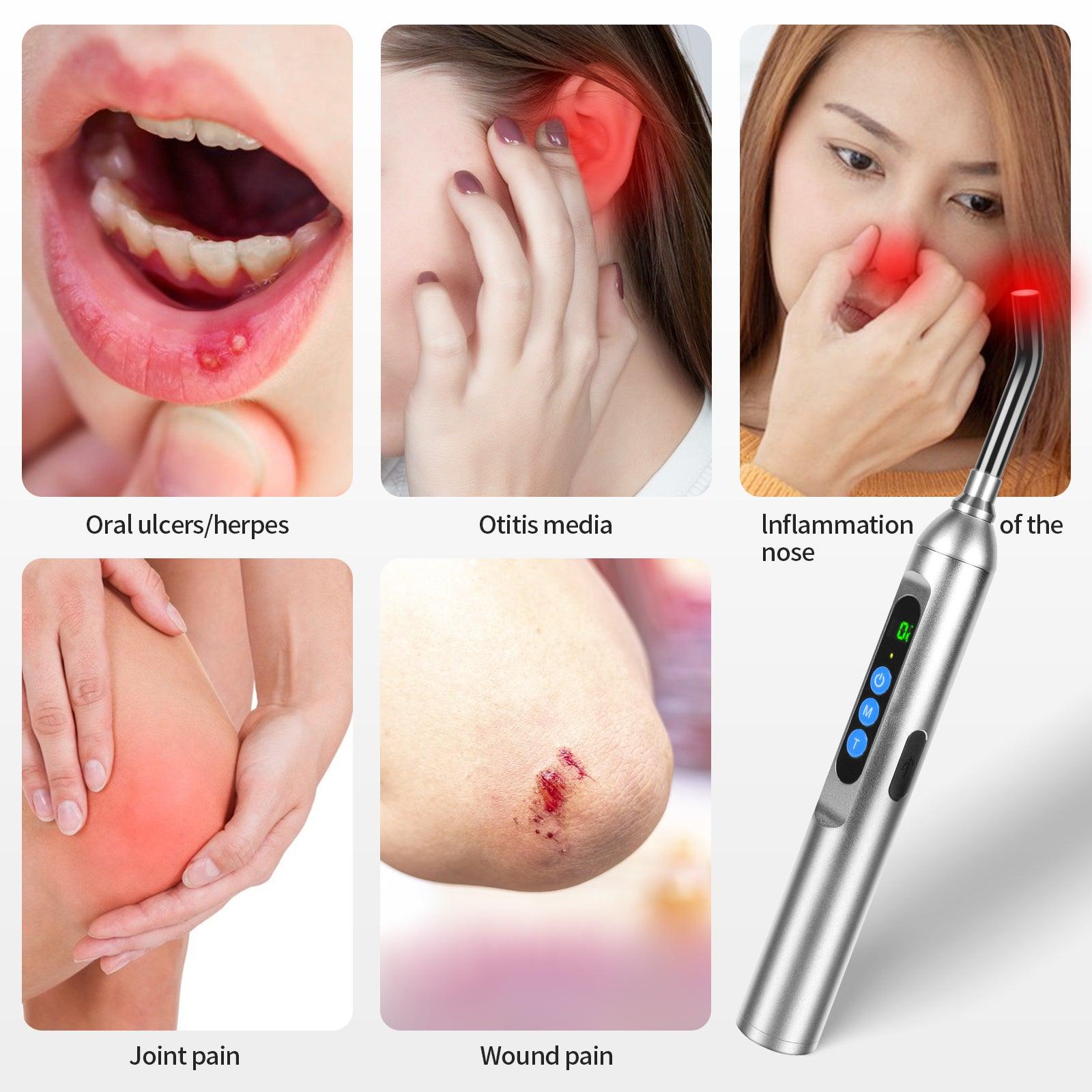 Youlumi Red Light Cold Sore Treatment Device - youlumistore